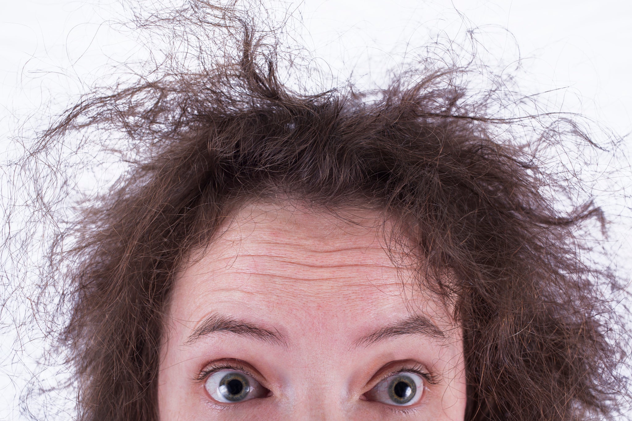 How To Get Rid Of Frizzy Hair? How To Prevent Frizzy Hair?