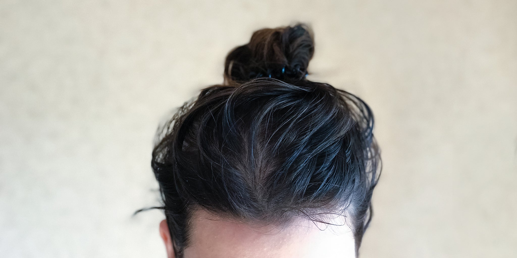 Scalp Inflammation: What is it and how to treat it?